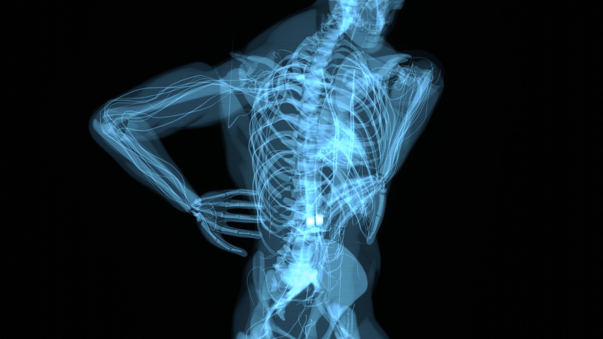 services-01 Abstract 3D motion design of backpain